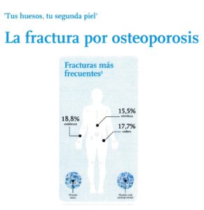 Lee más sobre el artículo Detección precoz de la osteoporosis