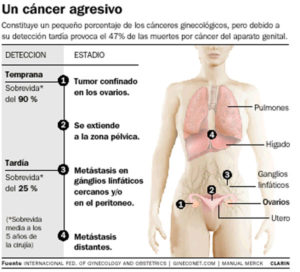 Lee más sobre el artículo Estudis genètics a Girona a pacients amb càncer d’ovari per buscar si és hereditari