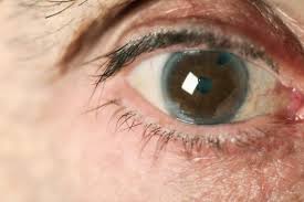 Lee más sobre el artículo Campaña de detección precoz de patología ocular